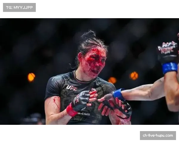 UFC PI启动“安全训练”倡议，为全球教练提供免费的脑震荡预防课程